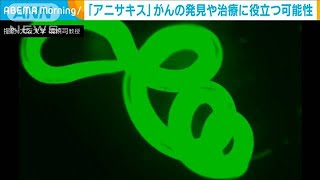 「アニサキス」がんの発見や治療法に役立つ可能性　大阪大学(2022年6月23日)