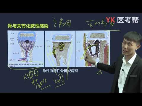 第六十八章 骨与关节化脓性感染 01 急性血源性化脓性骨髓炎