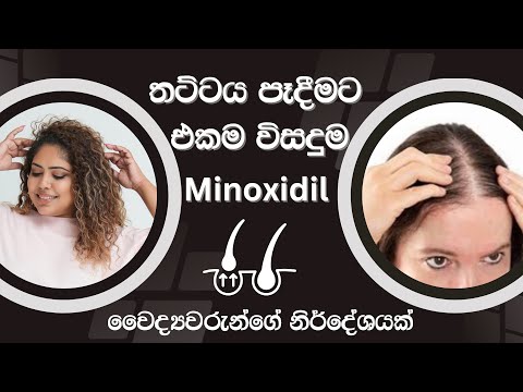 SOLUTION FOR HAIR FALL | MINOXIDIL