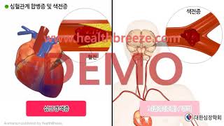 시연용 c0048aako 대한심장학회 심장전기생리검사 및 전극도자절제술 안내 동의서용