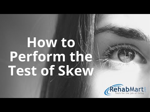 How to Perform the Test of Skew for Vertigo