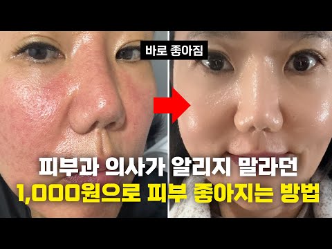 내일당장 피부 좋아지는법 /이것만알면 피부과 안가도 됩니다