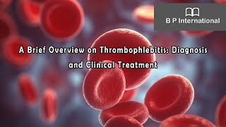 A Brief Overview on Thrombophlebitis: Diagnosis and Clinical Treatment