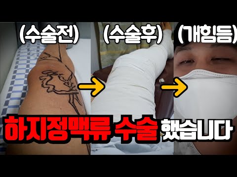 하지정맥류 수술 입원부터 퇴원까지 과정! 진통제는 제일 센걸로 맞으세요 제발.. 레이저 + 절개식 하반신 마취 수술 후기 갑니다!