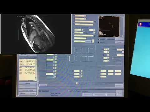 SSFSE MRI Scan with Sounds (Short Shot Fast Spin Echo