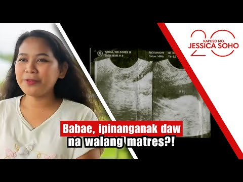 Babae, ipinanganak daw na walang matres?! | Kapuso Mo, Jessica Soho