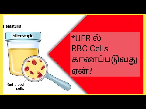 UFR ல் RBC காணப்படுவது ஏன் | Why RBC appear in urine? | Urine RBC normal range | STAR LABORATORY