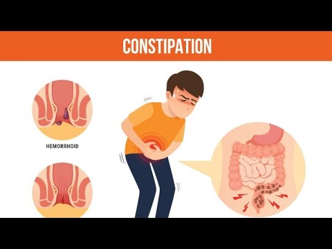 CONSTIPATION  - Symptoms,  Causes,  and Treatment   || Constipation  and the Colon.