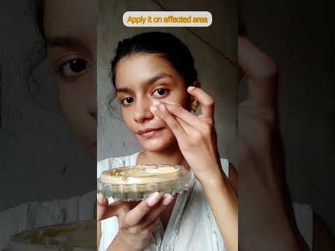 Home remedy for tanning 🌟|Visible results in first use 🌟✨|#naturalremedies #tanning #ishitasingh