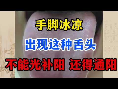 手脚冰凉，出现这种舌头，不能光补阳，还得通阳