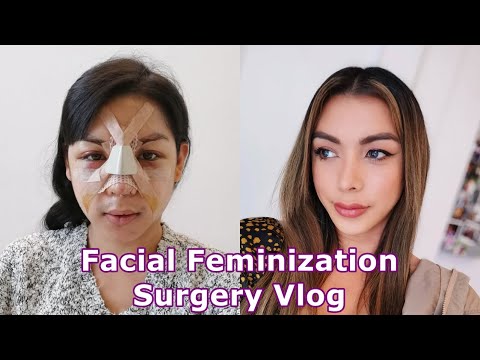 PLASTIC SURGERY IN KOREA : FACIAL FEMINIZATION SURGERY(FFS) PT.1