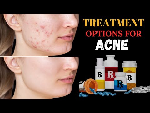 Acne: Understanding the Types of Acne and Treatment Options #facecam #face #drabbasofficial #fyp