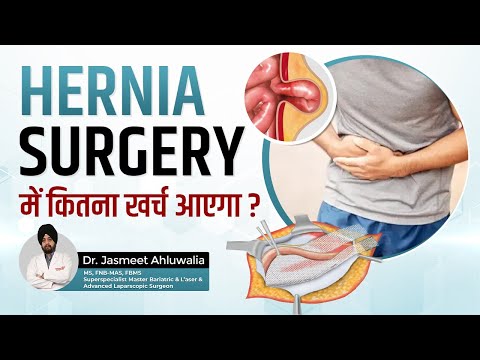 Cost of Hernia Operation in Hindi | Laparoscopic, Inguinal hernia Cost | hernia operation ka kharcha