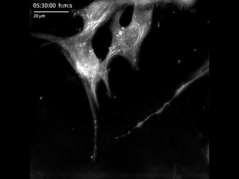 Nanolive Technology Unveils Impact of NETs on Cardiomyocytes