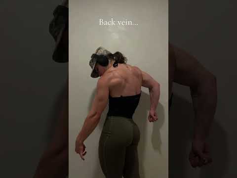 Back vein?