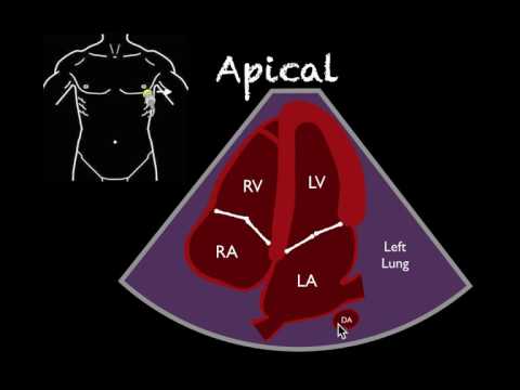 Bedside Ultrasound Basic Cardiac US