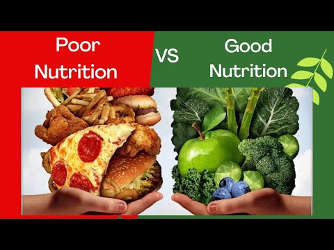 Good Nutrition VS. Poor Nutrition |Balanced Diet| 2020