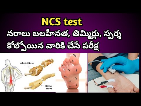 NCS Test ( Nerve Conduction Study) Procedure in Telugu