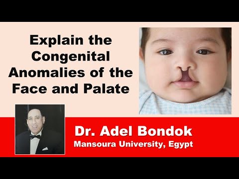 Explain the Congenital Anomalies of the Face and Palate, Dr Adel Bondok