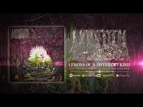 UNDEATH - LESIONS OF A DIFFERENT KIND (OFFICIAL AUDIO)