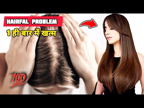 Hair Loss Problem Solution 💥 | Hair fall Ho Raha Ho kyaa Karen | Hair Fall Kaise Roke Home Remedy