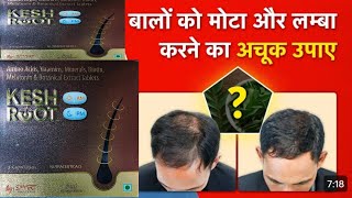 Keshroot tablet | Hair fall problem Medicine | केशरूट टैबलेट | जड़ते बालो को केसे रोके #keshroottab