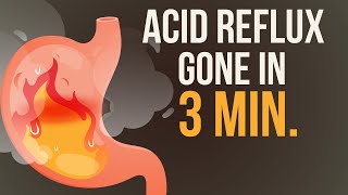 Reduce your Acid Reflux / Heartburn in just 3 Minutes! 🔥