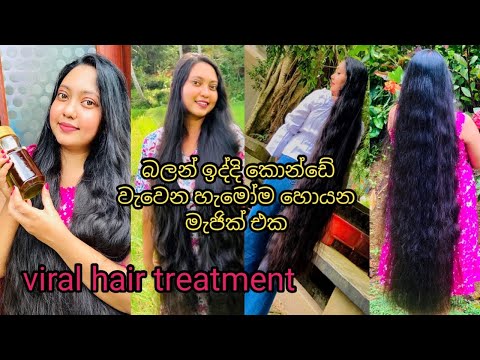 How To Grow Hair Faster /බලන් ඉද්දි කොන්ඩේ වැවෙන viral Hair treatment එක 🤫😳/Rosemary For Hair Grow