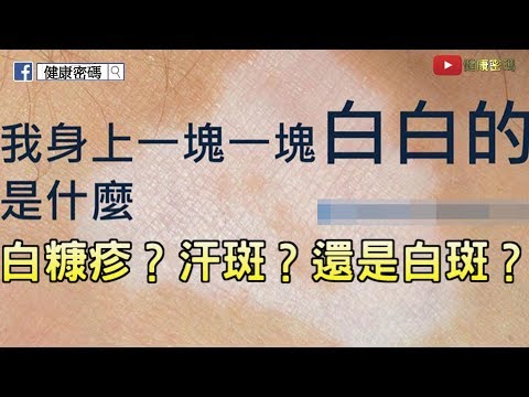 我身上一塊一塊白白的是什麼？搞懂白斑、汗斑、白糠疹