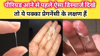 Period jaldi laane ke upay | Period jldi laane ke gharelu upay | Home remedies for irregular periods