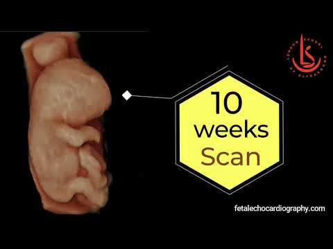 10 Weeks Scan Symposium: Future of Fetal Medicine