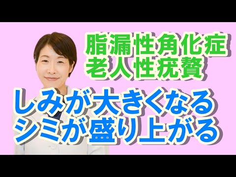 シミが大きくなったり、盛り上がる皮膚の病気【公式 やまぐち呼吸器内科・皮膚科クリニック】