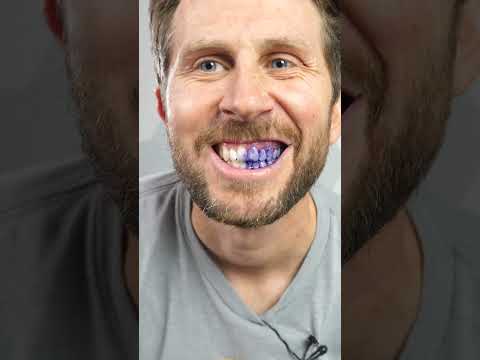 Purple Teeth Scam