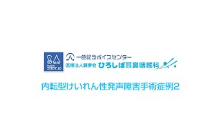 内転型けいれん性発声障害手術症例2