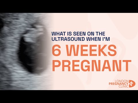 6 Weeks Pregnant: Witnessing the First Heartbeat on ultrasound scan