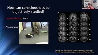 Neurology Lectures: Coma and other disorders of consciousness with Dr. Bauerschmidt