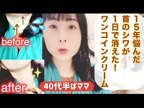 【40代ママ】え!？15年悩み諦めた首のシワが1日で消えた！