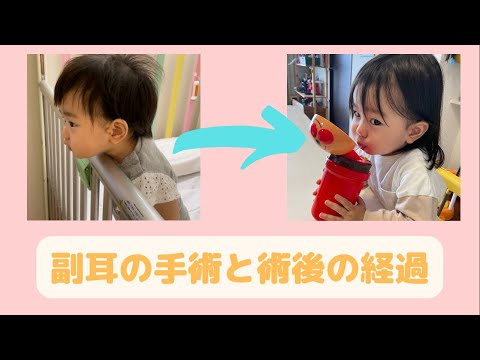 【副耳】切除手術の振り返りとその後の経過【※患部が映ります】