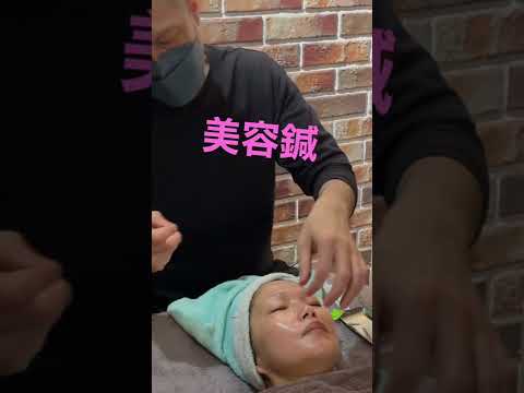 【美容鍼】定期的な美容鍼治療は小顔と美肌の管理に最適です！#美容鍼 #鍼灸治療 ＃小顔