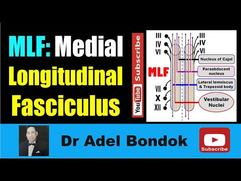 Medial Longitudinal Fasciculus (MLF), Dr Adel Bondok Making Neuronatomy Easy