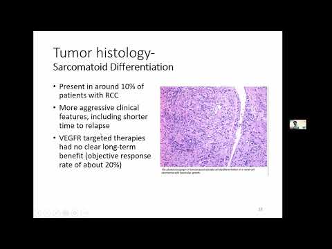 【2022全民泌尿抗癌日專業場】03 Biomarkers in the management of RCC鄒凱亦