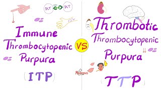 ITP vs TTP (Immune Thrombocytopenic purpura vs Thrombotic Theombocytopenic Purpura)