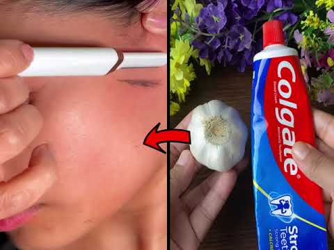 stop shaving! here's how to permanently get rid of facial, body and public hair