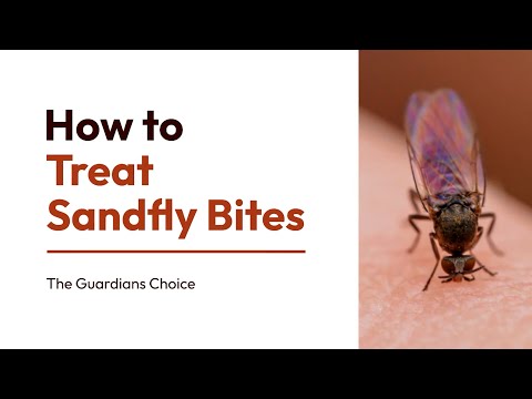 How to Treat Sandfly Bites Effectively! Discover the Proven Method