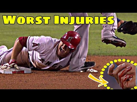 Worst Hand Injury in Baseball