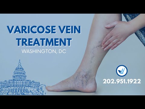 Varicose Vein Treatment Centers in Washington DC on K Street