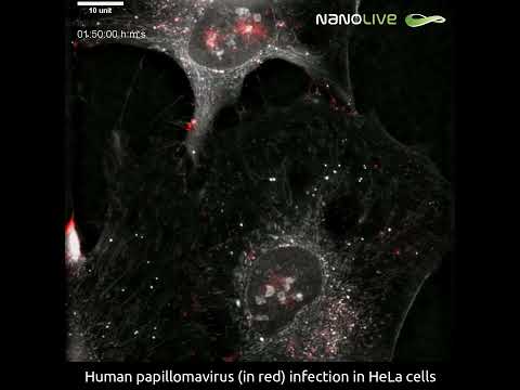 Human papillomavirus infection progression in living HeLa cells