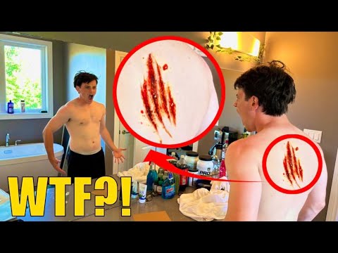 if you see this on your roommates back.. GET HELP immediately!! ( STROMEDY freaked out )