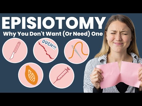 EPISIOTOMY while PUSHING | Avoid Perineal Laceration