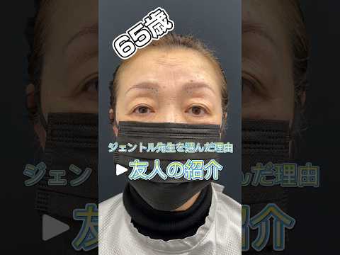 高難易度‼️65歳マダムの二重と眉下同時オペ‼️ #眉下切開 #ジェントル滝澤 #眼瞼下垂